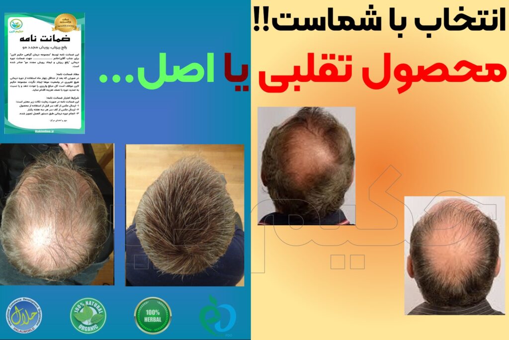 سرم سیر سیاه اصل