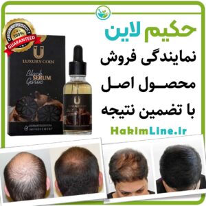 سرم اصلی سیر سیاه سرم سیر سیاه اصل سرم سیر سیاه اصل فرانسه فواید سرم سیر سیاه Black Garlic Serum – مرکز حکیم لاین