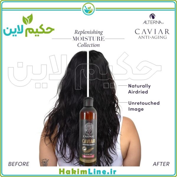 شامپو خاویار اصل | ضد ریزش، تقویت‌کننده و درخشان‌کننده مو | خرید از نمایندگی رسمی حکیم لاین