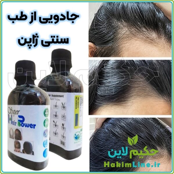 محلول گیاهی ضدریزش مو هیرپاور Hair Power حکیم لاین