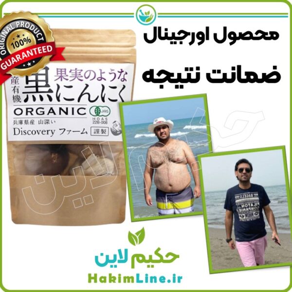 سیر سیاه اصل ژاپنی حکیم لاین ضمانت اصالت کالا