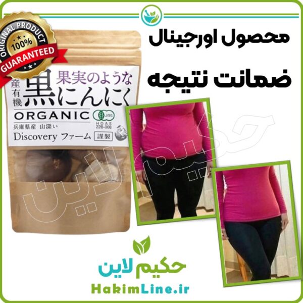 سیر سیاه اصل ژاپنی حکیم لاین ضمانت اصالت کالا