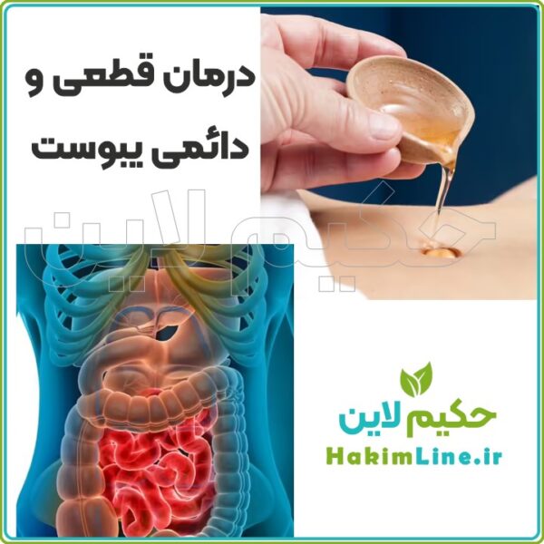 روغن گیاهی ختم‌ الشفا پایانی برای سردی، نفخ و یبوست (نمایندگی حکیم لاین)