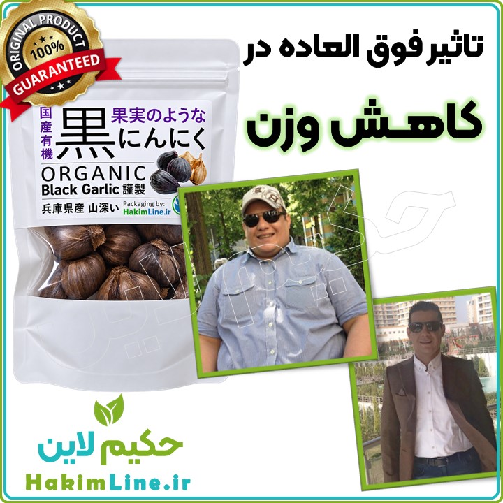 سیر سیاه ژاپنی - معجزه درمان کبد چرب، چاقی، غلظت خون و دیابت