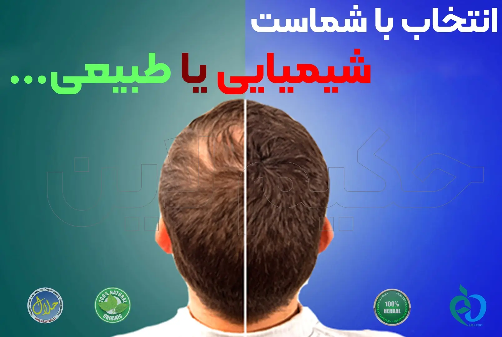 راهکارهای خانگی گیاهی و طبیعی برای درمان قطعی ریزش مو