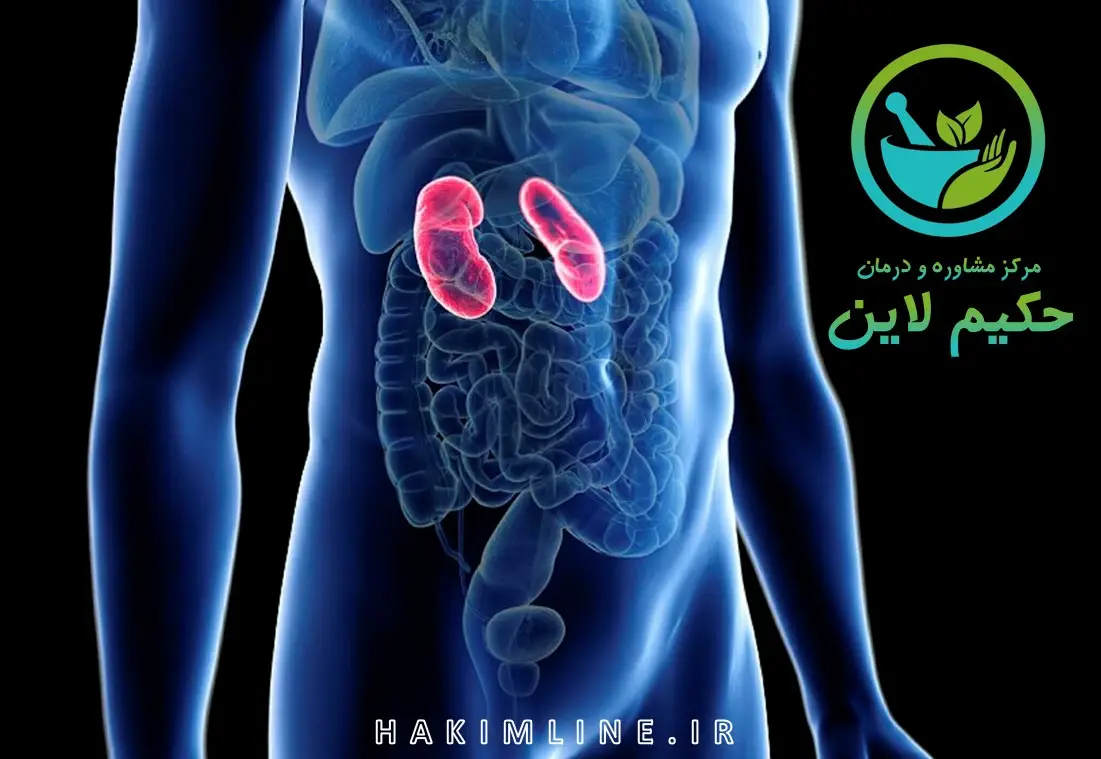 درد سنگ کلیه: راهنمای جامع پیشگیری، تشخیص و درمان